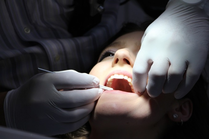 Come fare per avere i denti piu bianchi