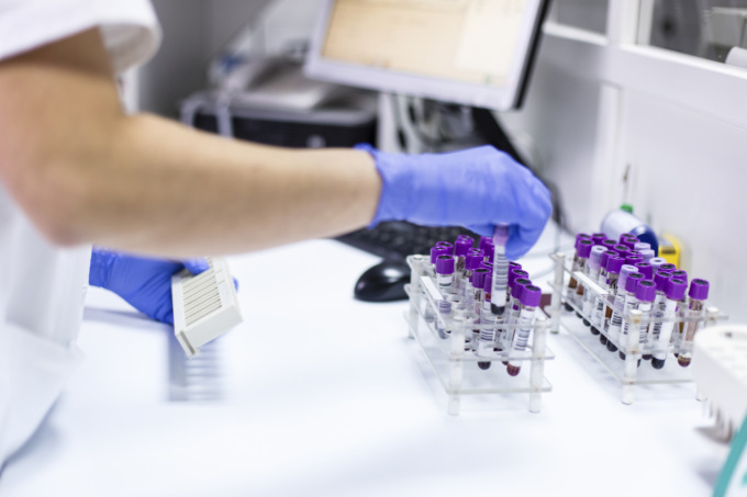 I vantaggi dell’autoanalisi del sangue in farmacia