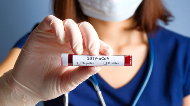 Perché si chiama Coronavirus? Che cos’è il Covid-19