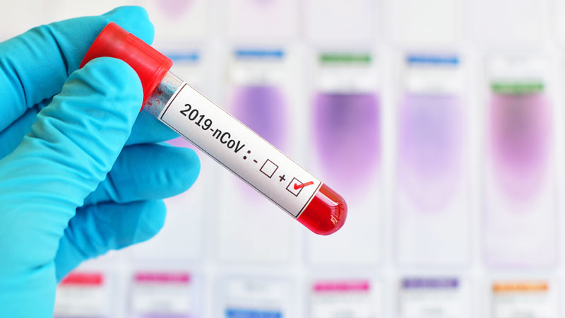 E’ arrivato in serata l’atteso nuovo decreto del Governo sul Coronavirus
