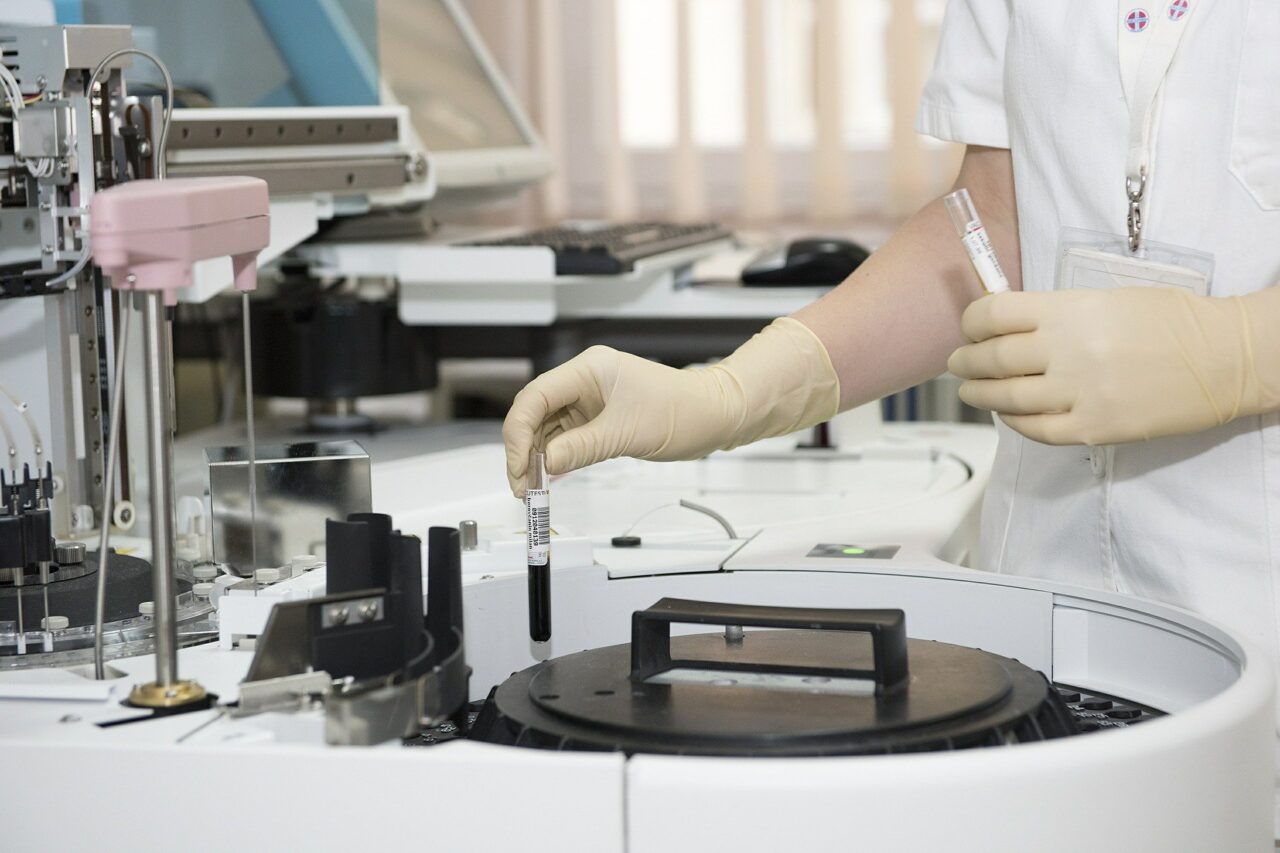 Regione Piemonte: tampone gratis anche ai privati che risultano postivi al test sierologico