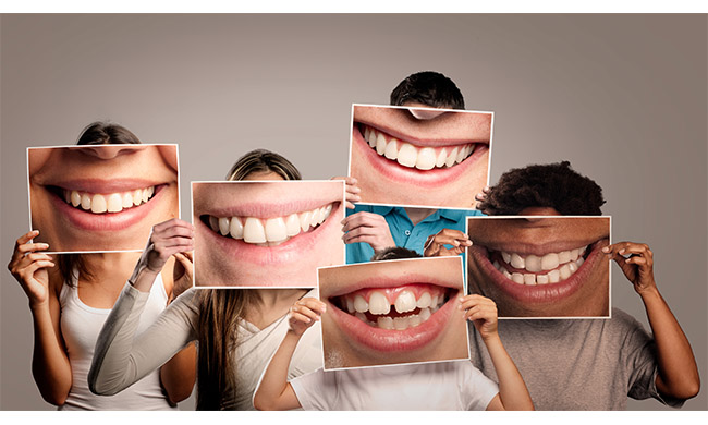 Sbiancamento professionale per un sorriso splendente