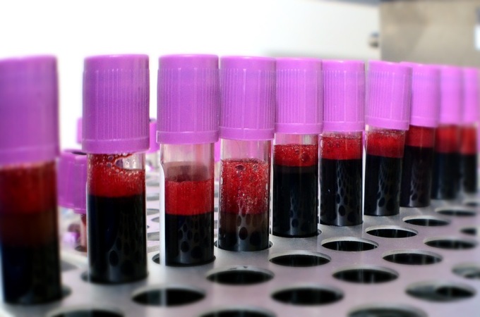 Donazioni di sangue, i numeri fra i giovani tornano a crescere