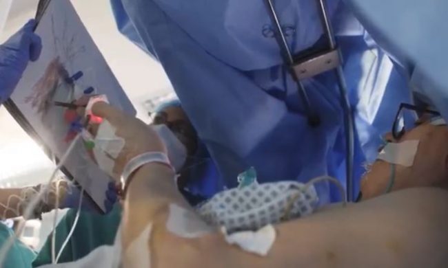 Durante l’operazione al cervello c’è chi suona, chi disegna e… chi prepara le olive all’ascolana