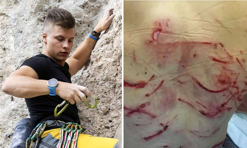 Il giovane carabiniere sopravvissuto al corpo a corpo con un orso