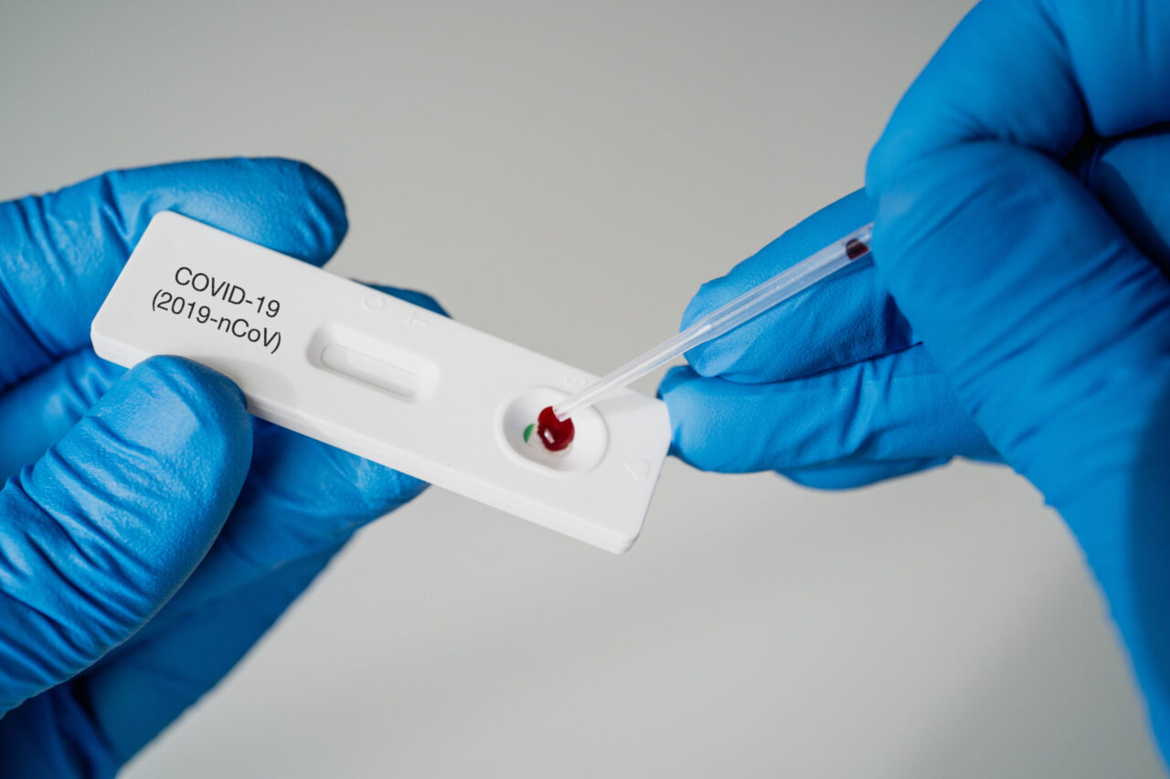 Medici di base veneti sull’obbligo tamponi: “Non trattateci come renitenti alla leva”