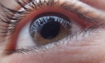 Come si previene il glaucoma e che cos’è?