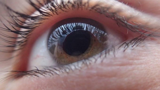 Come si previene il glaucoma e che cos’è?