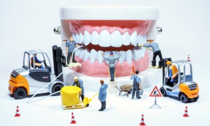 Prevenzione dentale fra visite periodiche, igiene e alimentazione corretta