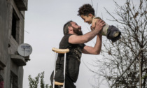 La foto simbolo della tragedia siriana: padre e figlio senza arti