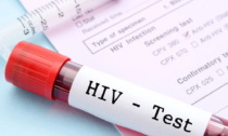 HIV e AIDS, le nuove diagnosi in Italia nel 2020