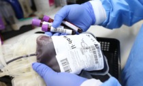 Trasfusioni sicure, da oltre 25 anni nessuno contagio di HIV
