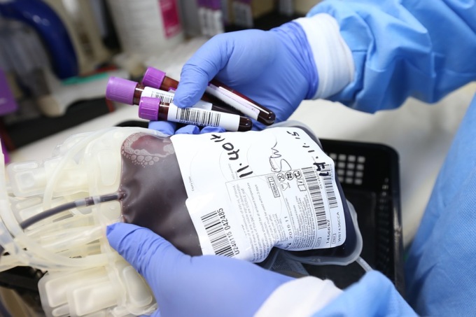 Trasfusioni sicure, da oltre 25 anni nessuno contagio di HIV