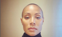 Alopecia, cos'è la malattia di cui soffre Jada Pinkett Smith, la moglie di Will Smith