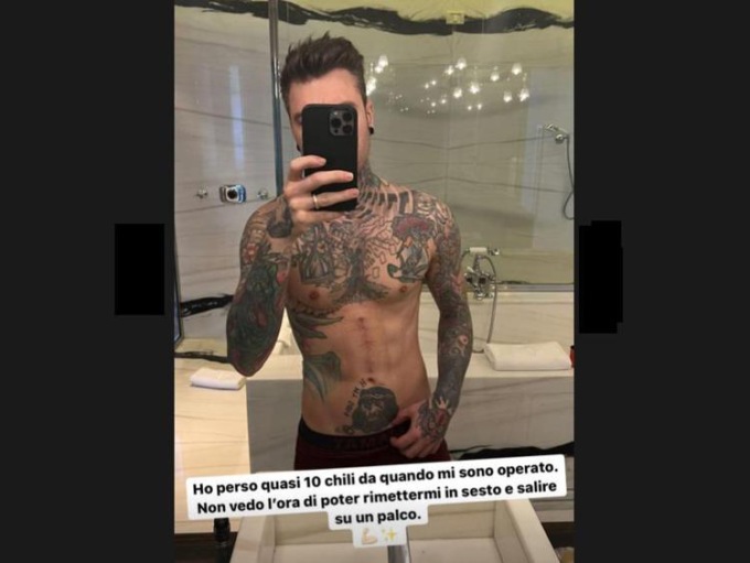 Fedez mostra il fisico e la cicatrice: “Ho perso quasi 10 chili dopo l’operazione”