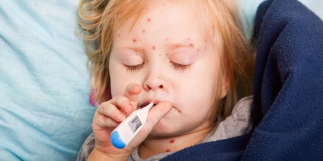 Casi  aumentati del 79% e vaccinazioni mancate: torna l’allarme morbillo