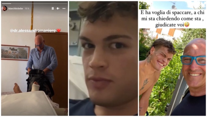 Blanco infortunato: dopo l’incidente ha dovuto mettere il gesso ad una gamba