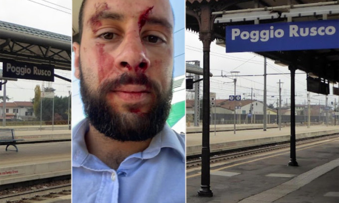 Macchinista difende una collega e viene picchiato: per i capitreno ora arrivano le bodycam