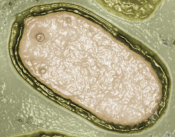 E’ stato “risvegliato” dagli scienziati un virus intrappolato nel permafrost per 50mila anni