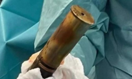 "Dottore, ho una bomba nel retto": ospedale evacuato per estrarre l'ordigno da un vizioso 88enne