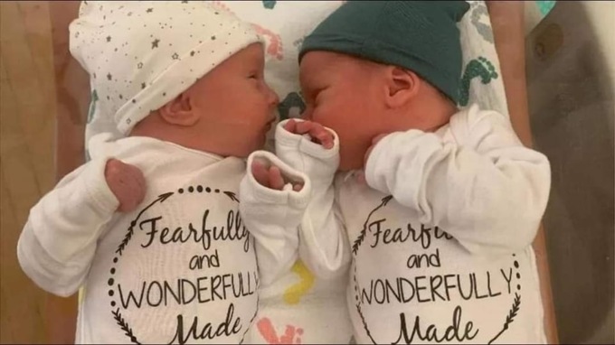 I gemellini che hanno solo tre anni in meno della mamma