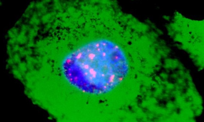 Studio italiano rivela che il Covid danneggia anche il Dna (e invecchia le cellule)