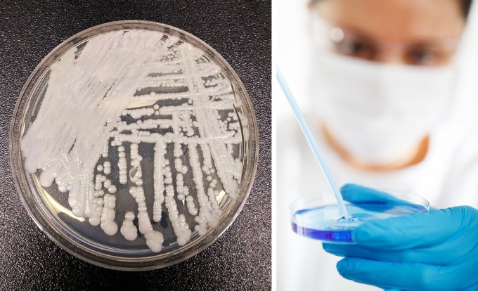 Candida auris: cosa sappiamo del fungo killer che ha ucciso un uomo a Milano. Caratteristiche, sintomi e cure