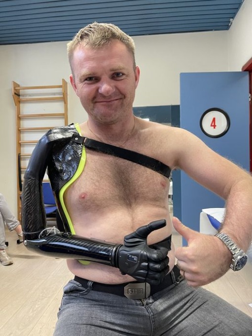 Quattro soldati ucraini riavranno mani e braccia grazie a protesi bioniche italiane