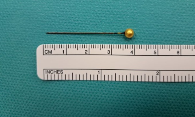 Sarta ingoia uno spillo di 4 centimetri che le si conficca nel polmone: salvata in ospedale