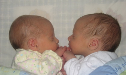I gemelli nati nello stesso istante: un caso rarissimo