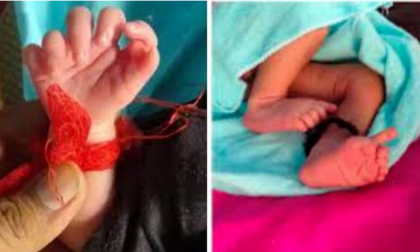 Bambina nata con 26 dita: condizione rarissima, ma per la famiglia è una dea incarnata
