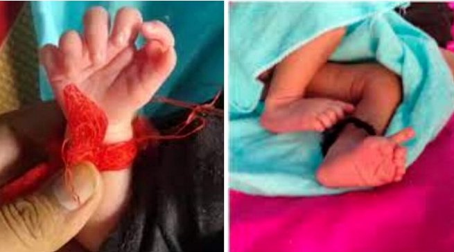Bambina nata con 26 dita: condizione rarissima, ma per la famiglia è una dea incarnata