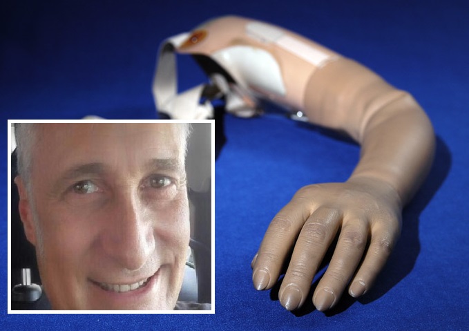 Il dentista no vax col braccio in silicone è stato radiato, ma continua a lavorare (e non solo lui)