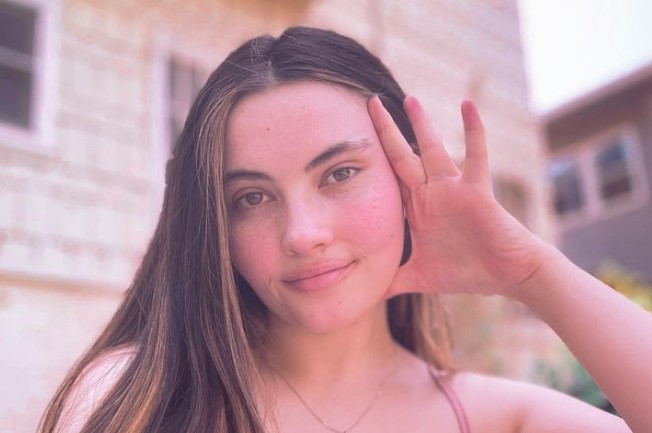 La ragazza allergica all’acqua: come vive, cosa beve e come si lava