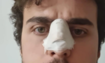 Prof cerca di sedare una rissa fra studenti: gli rompono il naso