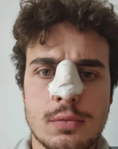 Prof cerca di sedare una rissa fra studenti: gli rompono il naso