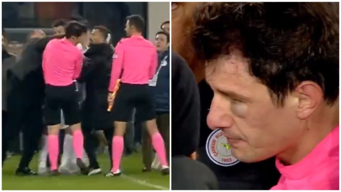 Turchia, presidente di calcio perde la testa e tira un pugno in faccia all’arbitro