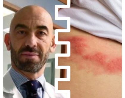 Non bastava il Covid, ora a infiammare la polemica sui vaccini c’è il fuoco di Sant’Antonio. Bassetti: Vaccinatevi!