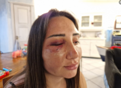 Massacrata in strada dall’ex, che cerca di gettarla nel vuoto. La testimonianza di Gaia: “Sono sopravvissuta, ma ho paura”