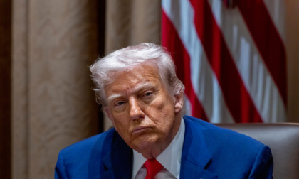 Trump soffre di insufficienza venosa cronica: caviglie gonfie e lividi sulle mani, ma è "in ottima salute"